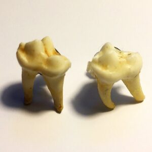 Teeth Earrings Jewelry